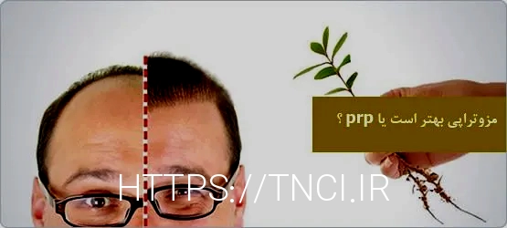 آر اف بهتر است یا هایفو
